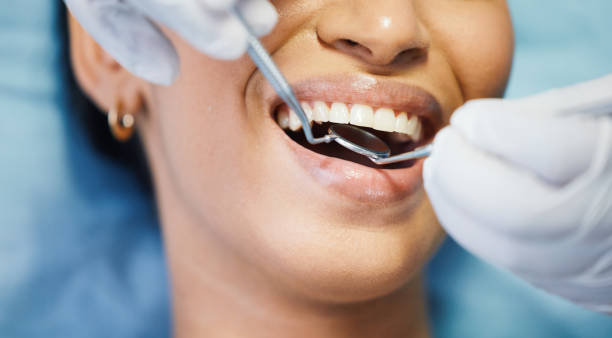 Best Emergency Wisdom Tooth Extraction in Nd Lake, WI